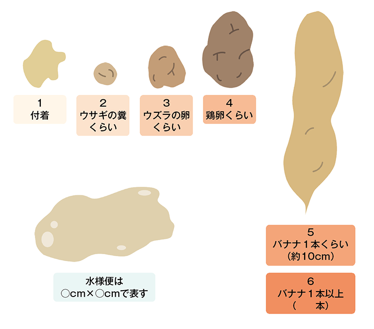 軟便 泥状便・水様便 ならぎょうとく内科・内視鏡クリニック浅草橋・蔵前