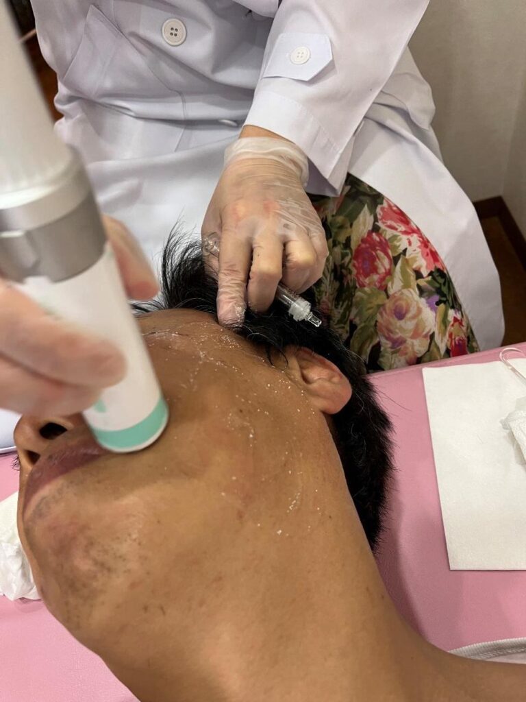 毛穴治療 黒ずみ・開き美容皮膚科はTCBスキンクリニック