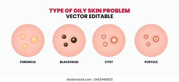 No.119 large scabs. pull out hairy dirt - YouTube