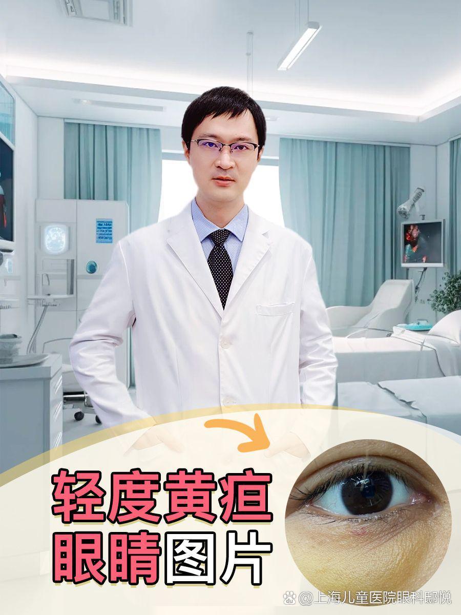 目、顔が黄色い・尿が茶色い岩崎医院北花田にある内科・外科・肛門外科