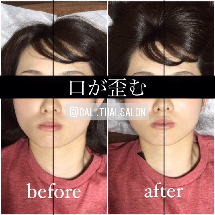 顔の曲がり・ゆがみ、顔面非対称の手術治療受け口などの顎変形症、あごえら・小顔矯正・性同一性障害の顔面輪郭、鼻整形、顔面変形、睡眠時無呼吸症候群の形成美容外科専門治療：東京警察病院形成外科・美容外科