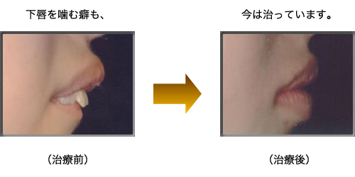 女は唇を噛む。神経性チック。強迫症。唇をかむ精神科医患者，ひっかき顔，爪をかむ，目のひきつり。接写、マクロ。」の動画素材 ロイヤリティフリー 1109374835Shutterstock