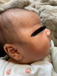 赤ちゃん 肌黒い 黄疸TikTok