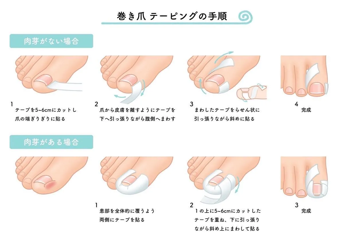 セルフケア 正しい爪の切り方編巻き爪巻き爪専門 自由が丘ひばり整爪院 東京都世田谷区