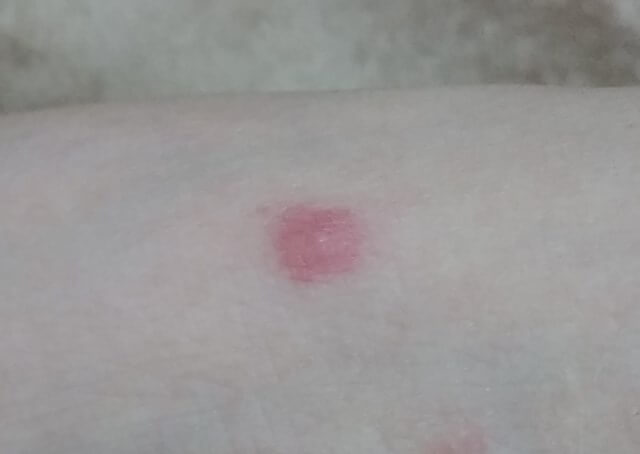 愛犬・愛猫にノミを見つけてしまったら 😱 - シリウス犬猫病院