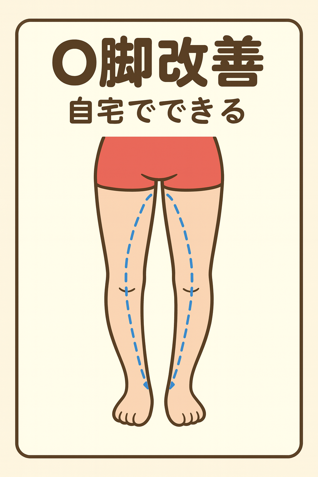 反り膝の治し方反り膝による膝の上のお肉 反り膝矯正ストレッチくまなべ整体 整体師が教える 綺麗な体のつくり方