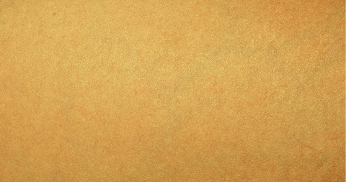 Check it now! Pay attention to the color of your palms! Palm diagnosisreveals hidden illnesses - YouTube