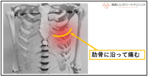 引っ越し作業後の前胸部の痛み品川駅周辺 はりきゅう専門の鍼灸院はりきゅうルーム カポス