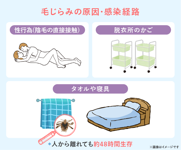 シラミにご注意を武蔵小杉の皮膚科・形成外科 - 小杉町クリニック