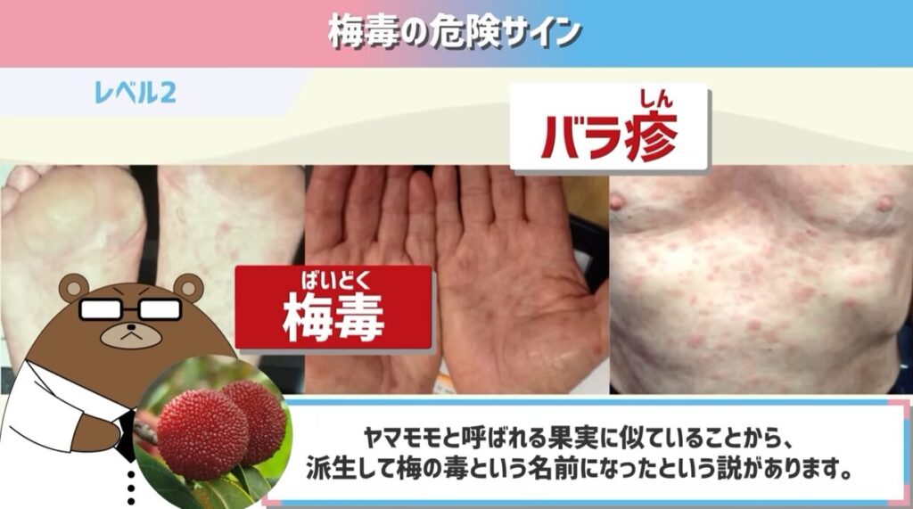 梅毒の症状、診断方法、検査について新宿駅徒歩1分の性感染症の治療