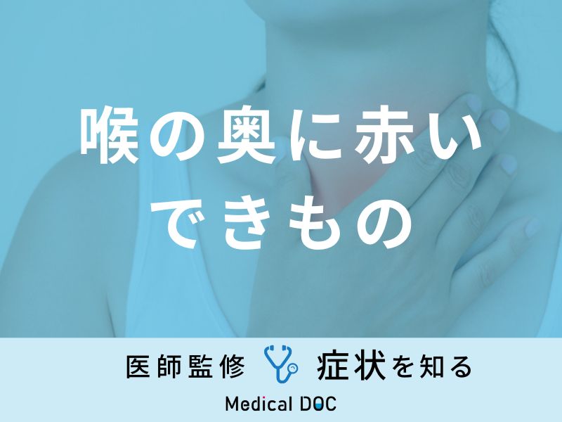 風邪？扁桃炎？咽頭炎？違いと対処法を医師がわかりやすく解説 - わかばファミリークリニックブログ