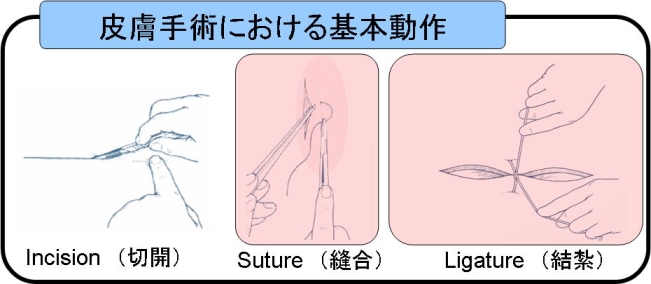 適切な縫合とは？ – 医療法人 双英会 YUKI皮フ科形成外科一宮市時之島の皮膚科、形成外科