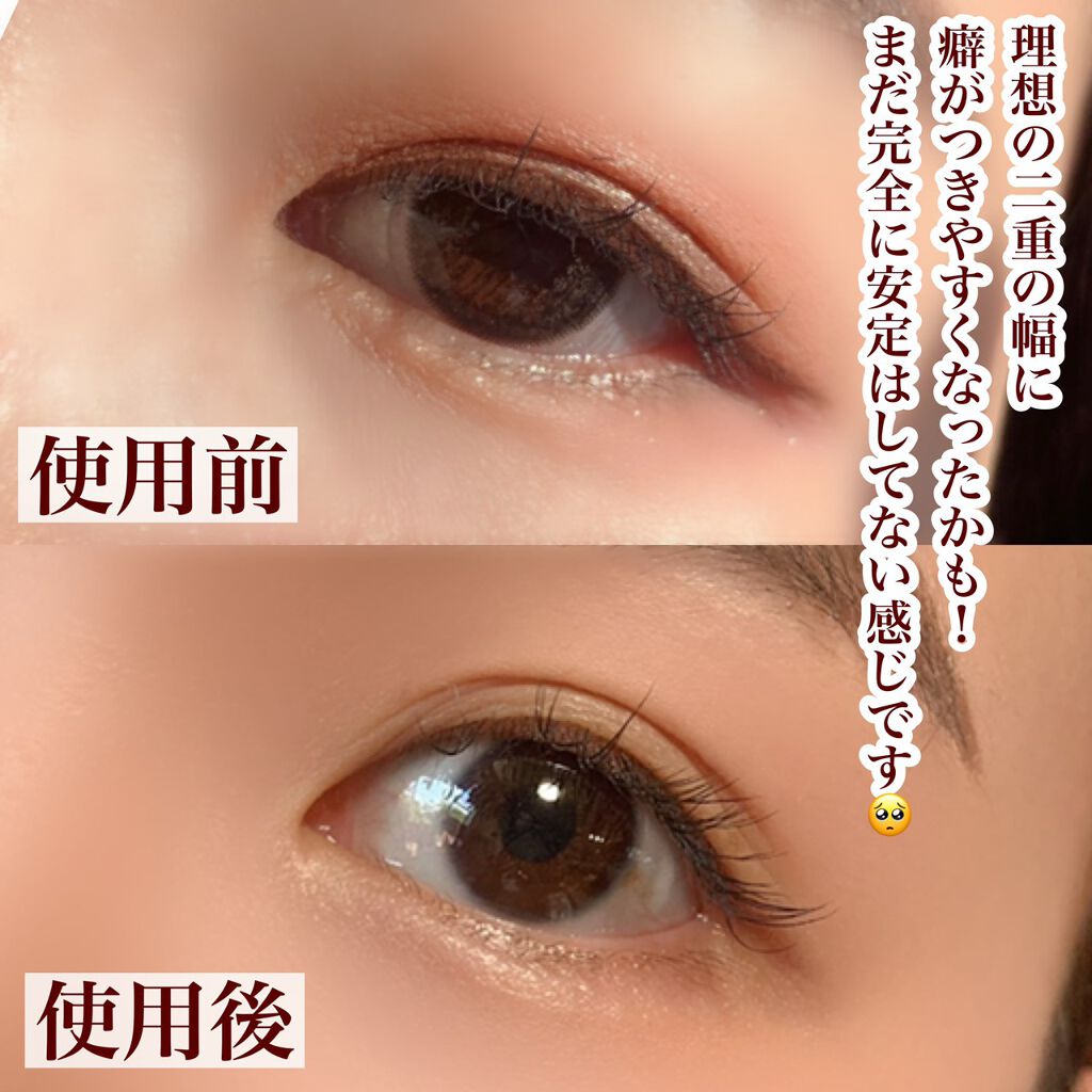 Amazon.co.jp: Night eye Beaute IIナイトアイボーテ3ml 二重形成コスメ 夜用 二重形成液 二重のり アイテープ美容成分 一重 奥二重 アイメイク くせ付け : ビューティ