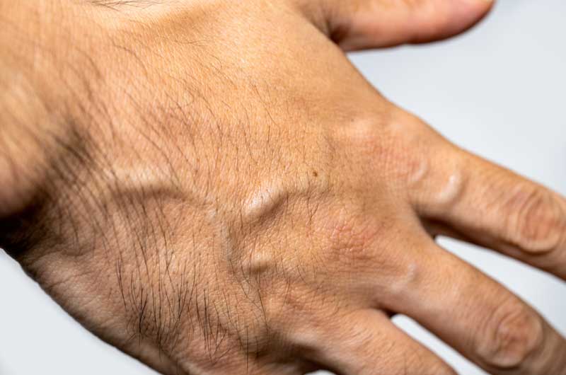 手の甲と指の毛穴を消す方法を教えてください - 手綺麗な男性- Yahoo!知恵袋