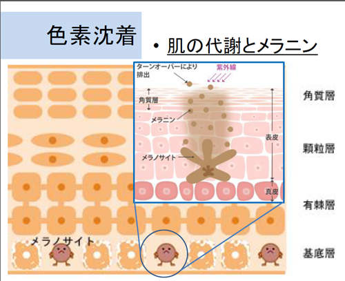 デキサメタゾン治療により色素沈着が著明に改善されたAddison病の1例臨床皮膚科 54巻4号医書.jp