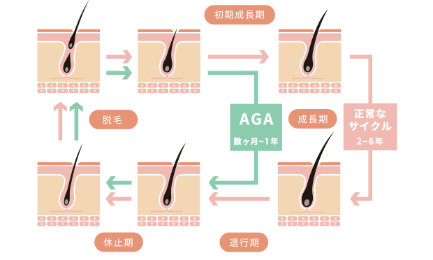 AGAの基礎知識：図解でわかりやすく解説 - 表参道メディカルクリニック