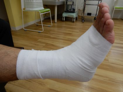 楽天市場 *小児の足骨折セット 松葉杖と子供用ギプスサンダルのセット 適応身長約120cm〜129cmまで ※かいかい棒付き 子供用松葉杖 小さい松葉杖極小松葉杖 松葉づえ こども用: ひと、モノショップ