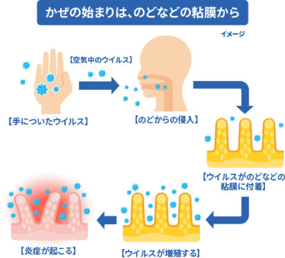 のどの病気 戸塚耳鼻咽喉科クリニック戸塚駅徒歩2分の耳鼻科