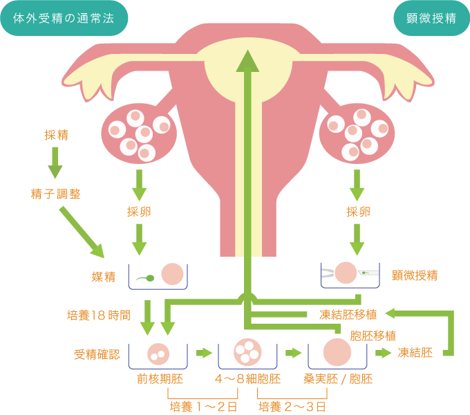 今日の卵 vol.3医療法人オーク会 不妊ブログ