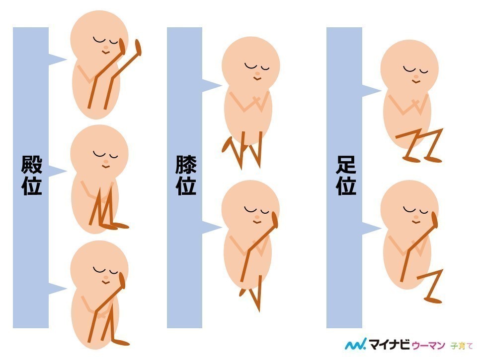 妊娠37週6dで逆子から頭位になったので胎動の位置の変化レポ！笑 - 保育士うたのサイト