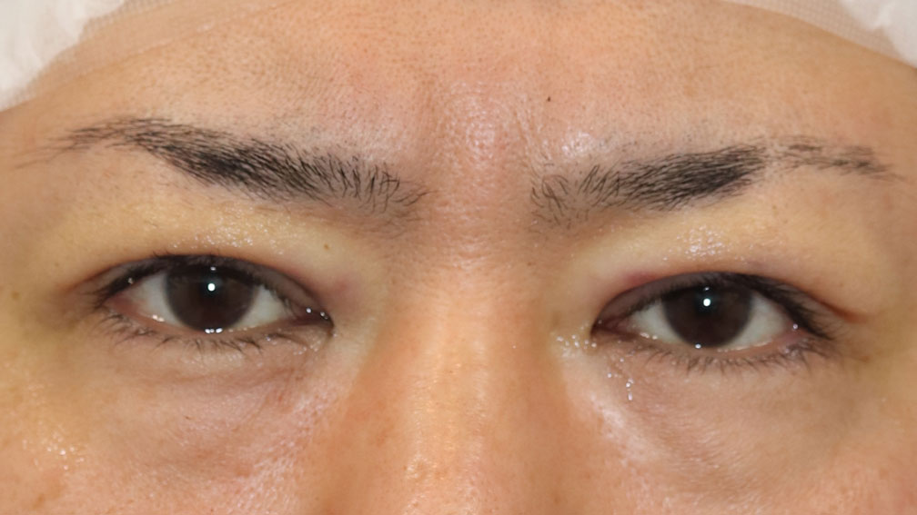 ピンクのアイシャドウ使うと目が腫れぼったくなる〜！って、暖色系好きなのになかなか使えない人はこの塗り方を試してみてください✨,1.目尻に塗って、目の中央までぼかす, 2.下まぶた目頭側に塗ってアクセントにする, 3.下まぶた目尻側に塗ると血色感がアップするし、タレ目効果あり,どうしても全体に塗りたいな、っていう時は, 目のキワにだけ暖色系カラーをのせて,