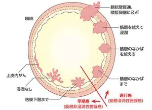 腹痛 お腹の痛み の原因と対処法・検査・治療について東京都新橋駅徒歩1分の消化器内科・泌尿器科クリニック
