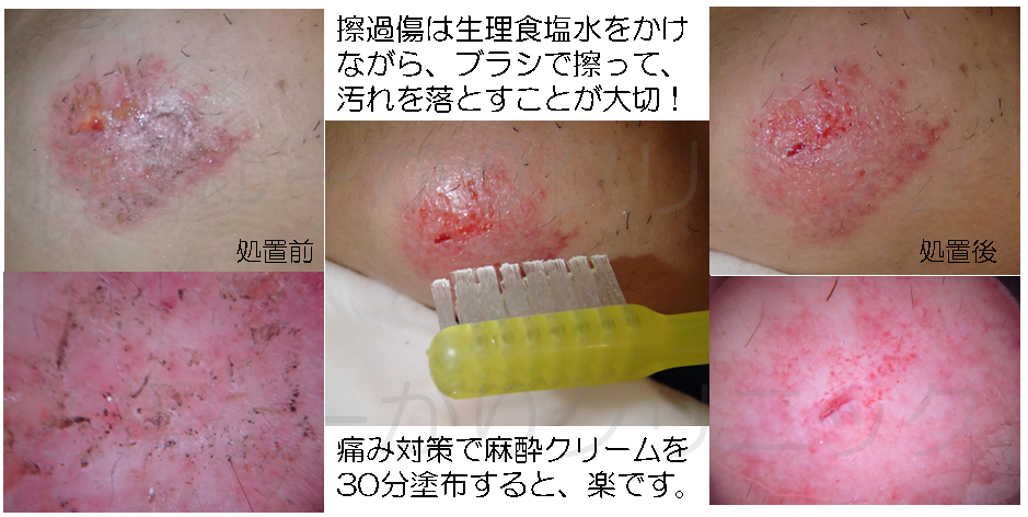 楽天市場 傷 軟膏の通販