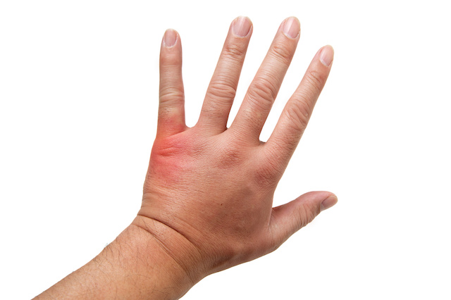 蜂に刺されたら？蜂の種類により生活や行動も様々です 蜂の巣駆除センタ