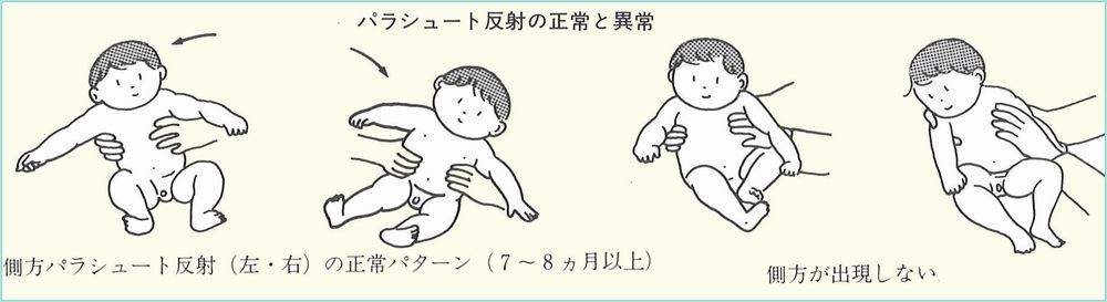 第52回 H29理学療法士国家試験 解説 午前問題16～20- 通所型基準緩和サービス施設 明日へ ブログ