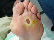 糖尿病と皮膚の病気江草玄士クリニック