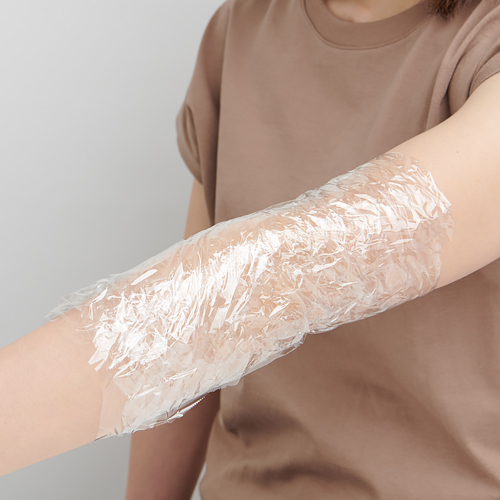 夏場に気になる、ひじ・ひざの黒ずみ、悪化するNG習慣は? - ウェザーニュース