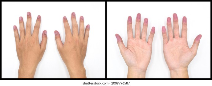 循環器内科でよくある症状品川区のはるクリニック西小山西小山・洗足・武蔵小山の循環器内科