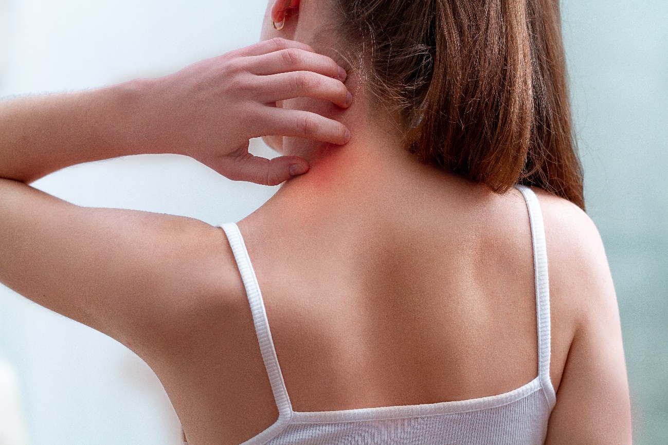 乾癬とは乾癬ネット