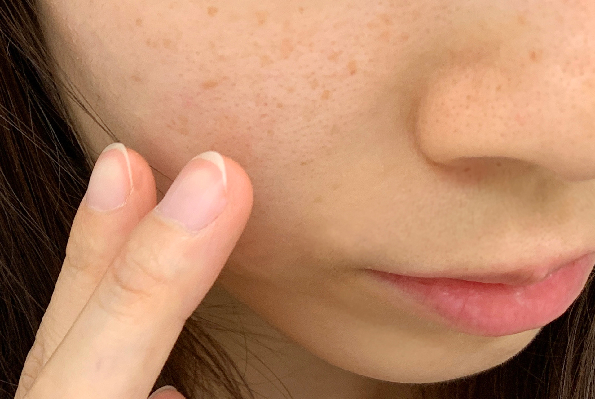 スキンケアシミ光治療やりすぎないスキンケアすっぴんドクター小林美幸小林美幸ブログ聖心美容クリニック聖心美容クリニック熱海院熱海シミレーザーNトレチノイン532フラクショナルVAエッセンス美肌エクソソーム素肌聖心