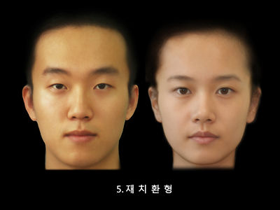 日本人 東アジア人 と欧米人の顔は何が違うのか？見た目だけじゃない歯並びの大切さ