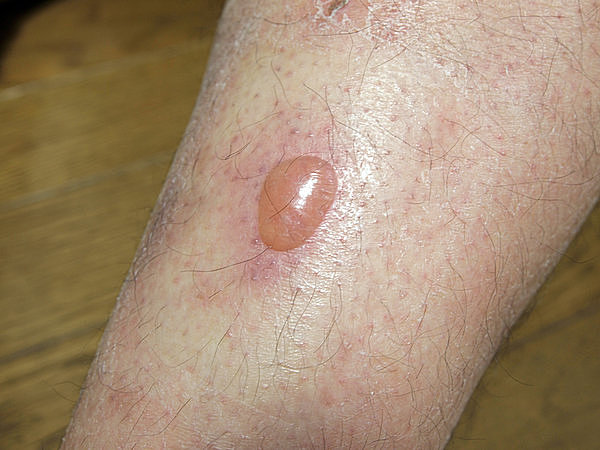 ずっとこたつにいると太るってホント？吉祥寺 筋膜リリース×体質改善 一生モノの健康美