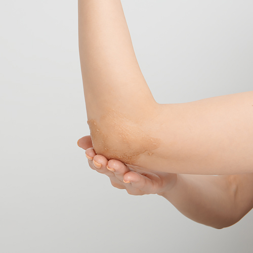 半袖の季節になったら要注意！ひじが黒ずむ NG習慣と3つの解消法、教えます！美ST ONLINE