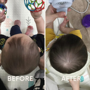 小頭症の新着記事アメーバブログ アメブロ