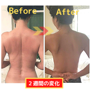 リンパマッサージ、もみほぐしの理想的な頻度はどれくらい？ - RELAMO リラモ 布施本店