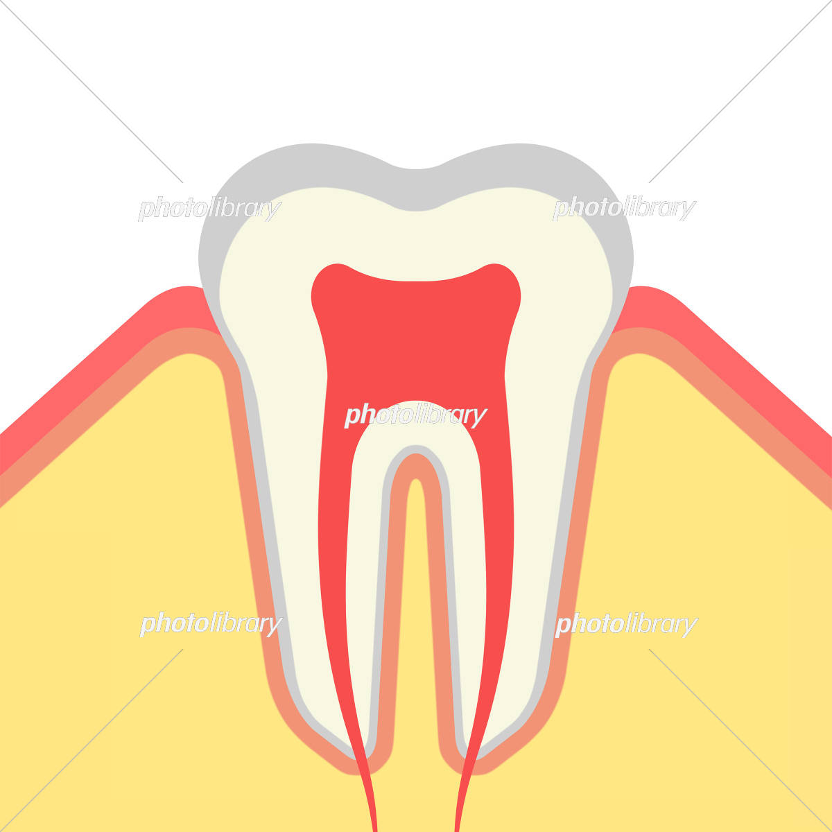 1,300点を超える象牙質のイラスト素材、ロイヤリティフリーのベクター素材グラフィックスとクリップアート - iStock