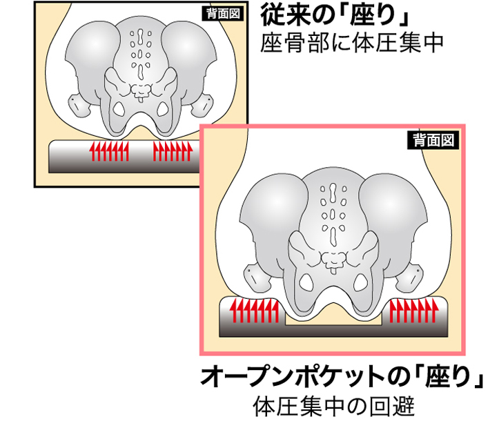 坐骨神経痛・お尻の痛みの原因と改善方法