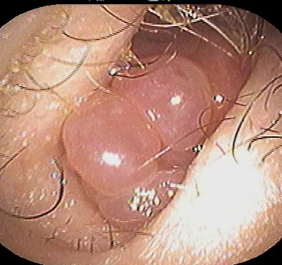 見てわかる鼻の病気 耳鼻咽喉科内藤クリニック