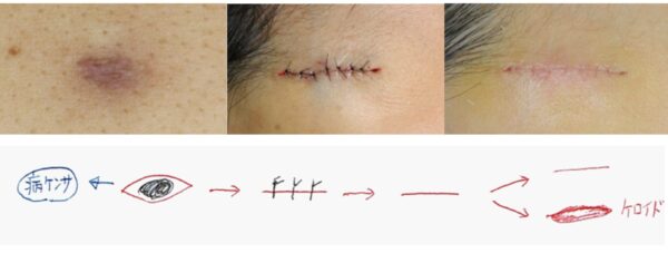 保険適用のできもの・しこり治療 世田谷区駒沢の形成外科はネス駒沢クリニック 形成外科・美容