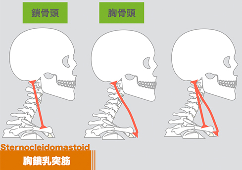 胸鎖乳突筋の痛みの原因とは？セルフケア方法と予防策を解説 - 株式会社リハサク