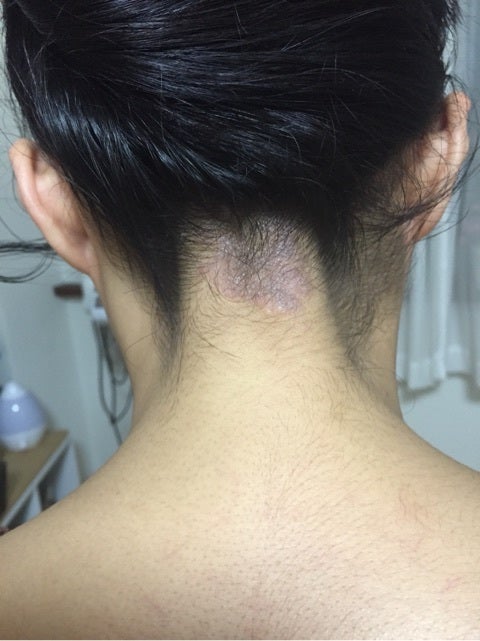 うなじと襟足の違いは？脱毛できれいなデザインを作る方法も説明！大阪・梅田の医療脱毛ミセルクリニック 公式