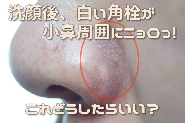 洗顔したのに「白い角栓」が出てくる原因と正しいお手入れ方法注目のフェイスケア情報をまとめてチェック！ママテナ
