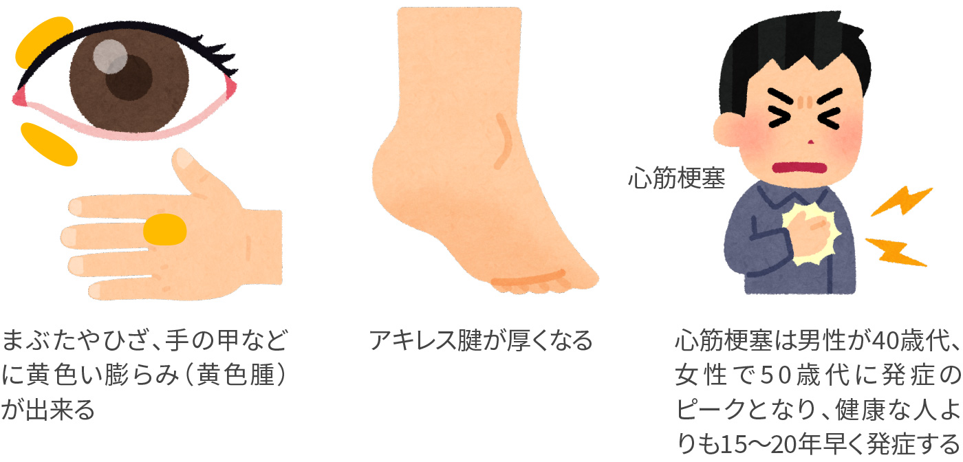 眼瞼黄色腫を治療するなら