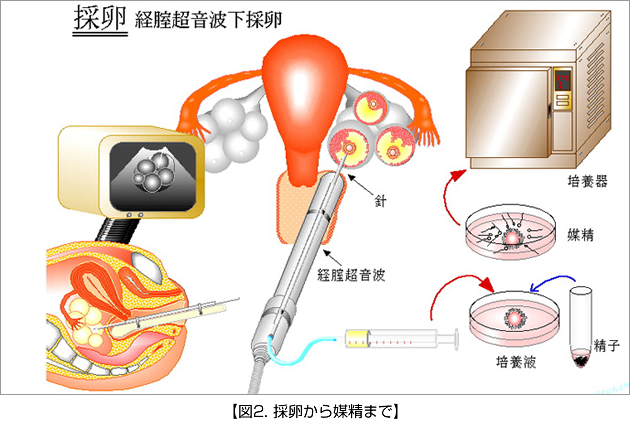 Q&A 男性も理解すべき、「妊娠とテクノロジー」の話