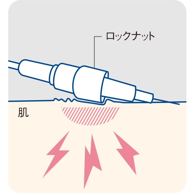 薬の内服や注射をする時に発症する薬疹 やくしん とはあさ美皮フ科亀戸駅前