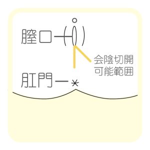 大阪で会陰部贅皮切除を受けるならWクリニック